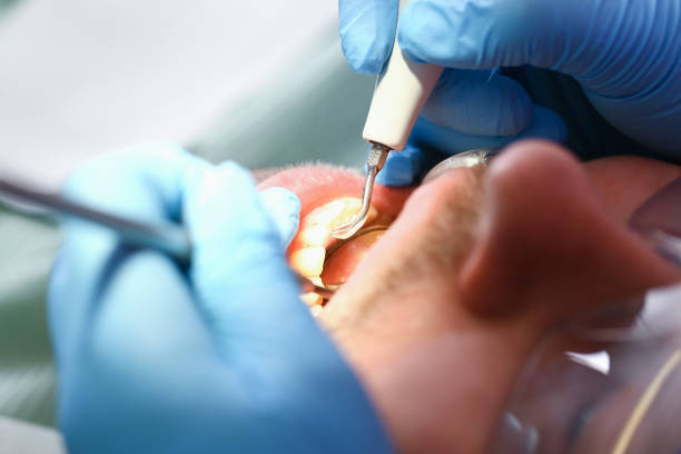 Best Emergency Treatment for Toothache in Parkersburg, IA