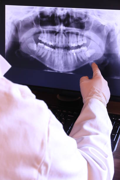Best Emergency Broken Tooth Repair in Parkersburg, IA