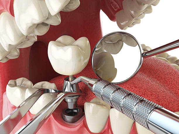 Best Walk-In Emergency Dentist in Parkersburg, IA
