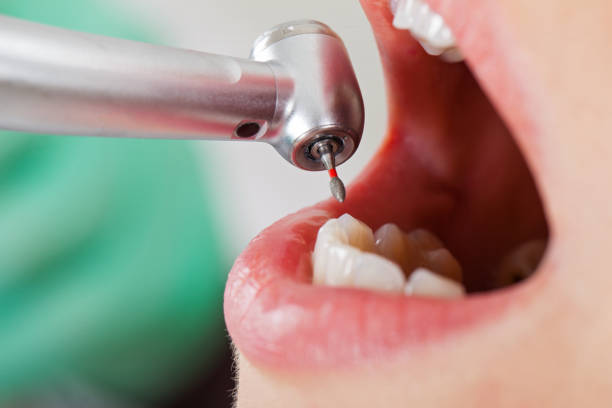 Best Pediatric Emergency Dentist in Parkersburg, IA